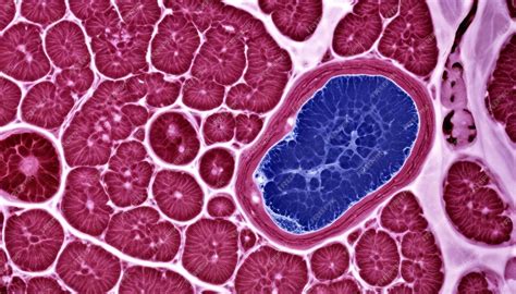  Alluminio: Una Visione Microscopica del Metallo che Conquista il Mondo!