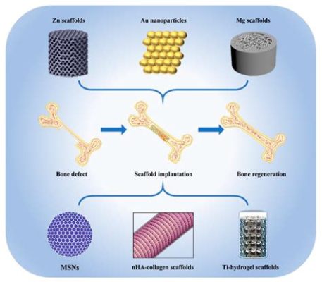  Zincite Nanoparticelle: Materiali Innovativi per l'Ingegneria Tissutale e la Terapia Genica